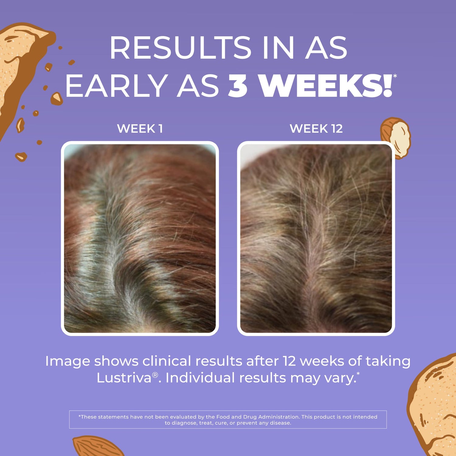 MaryRuth's Hair Growth Max Liposomal 15 oz